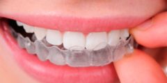 Invisalign Clínica Ortodoncia Pedro Vázquez